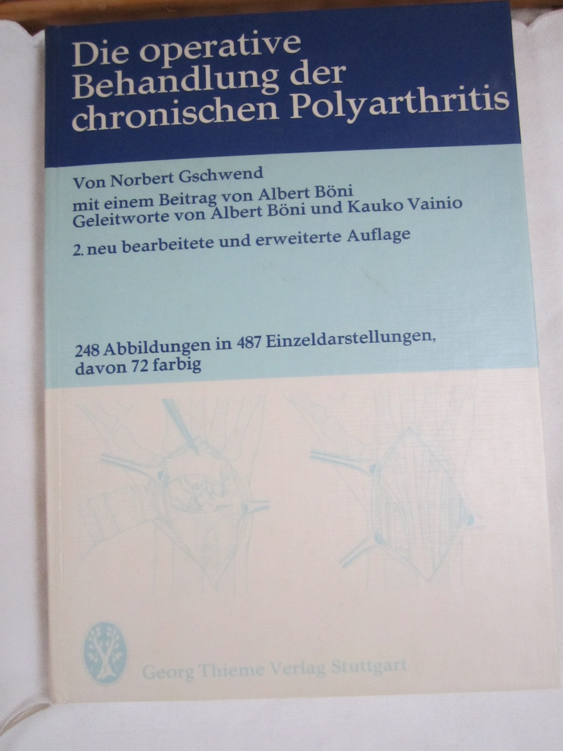 Product Image: Die operative Behandlung der chronischen Polyarthritis
