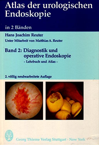 Atlas der Urologischen Endoskopie II. Diagnostik und operative Endoskopie Medicine