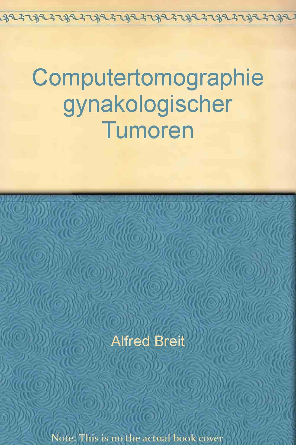 Computertomographie gynäkologischer Tumoren Medicine