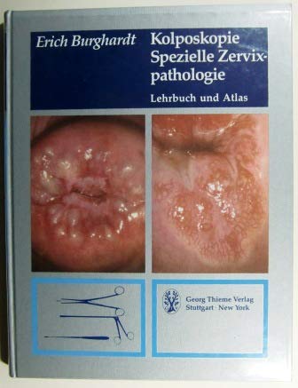 Kolposkopie, Spezielle Zervixpathologie. Lehrbuch und Atlas Books