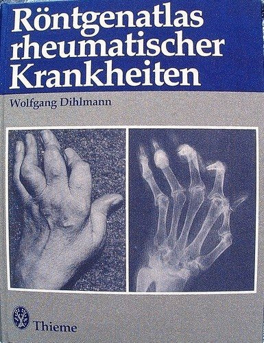 Röntgenatlas rheumatischer Krankheiten Medicine