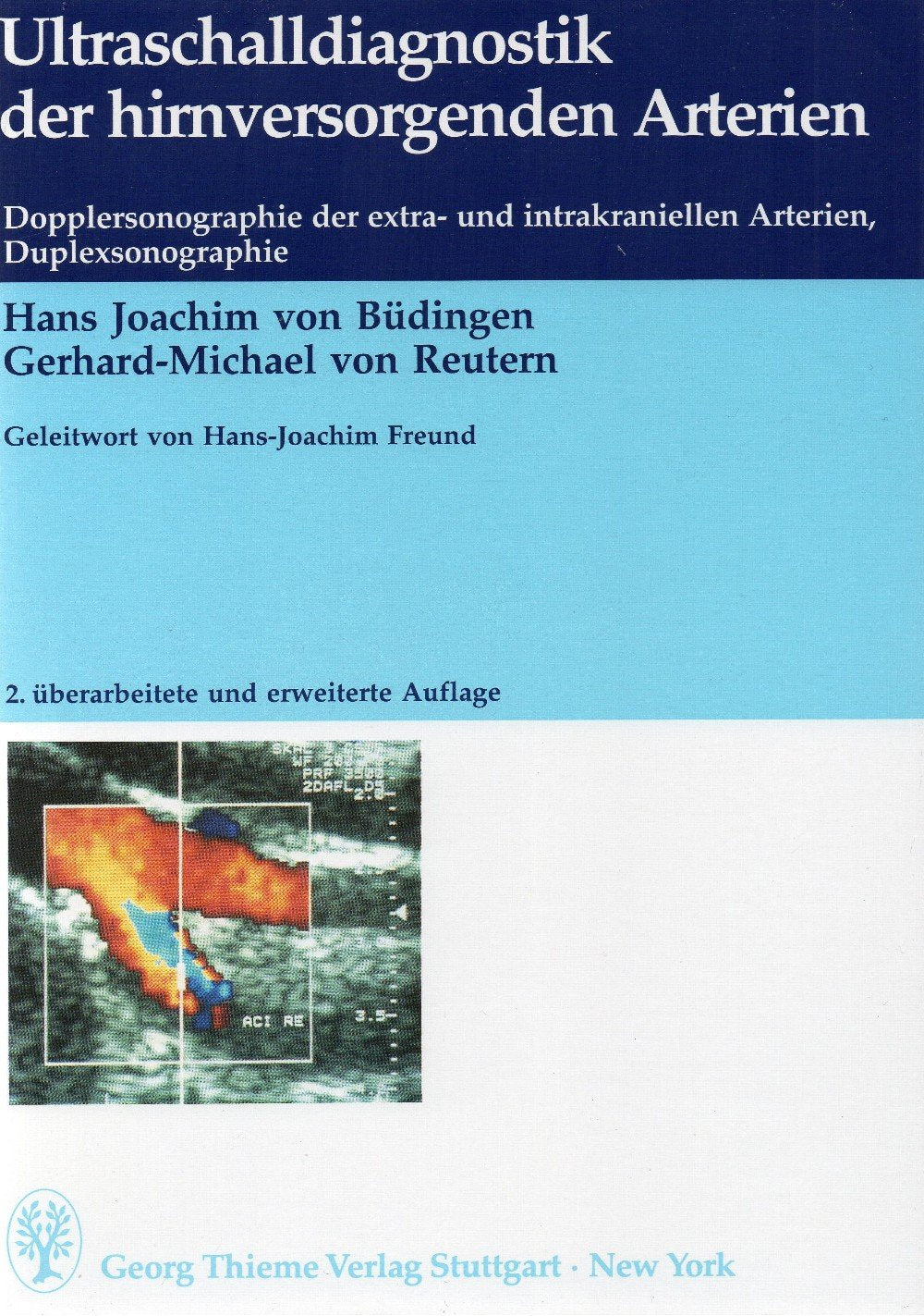 Ultraschalldiagnostik der hirnversorgenden Arterien Medicine