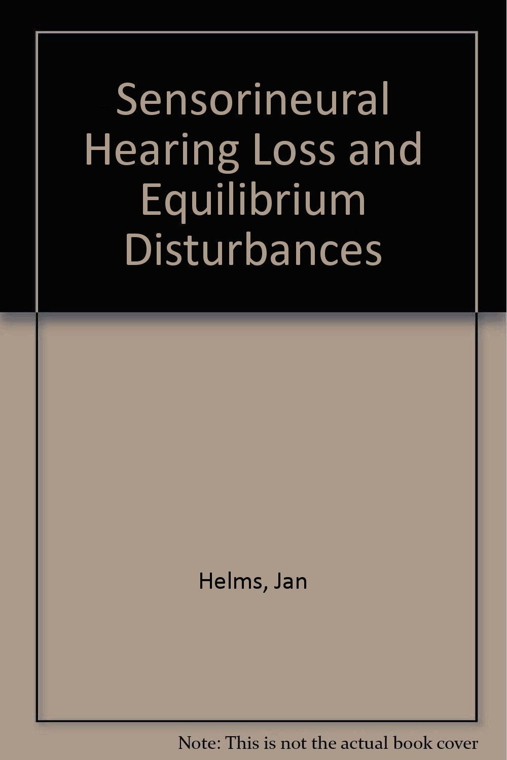 Sensorineural Hearing Loss and Equilibrium Disturbances Medicine Books