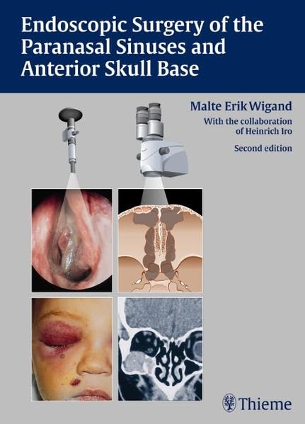 Endoscopic Surgery of the Paranasal Sinuses and Anterior Skull Base book