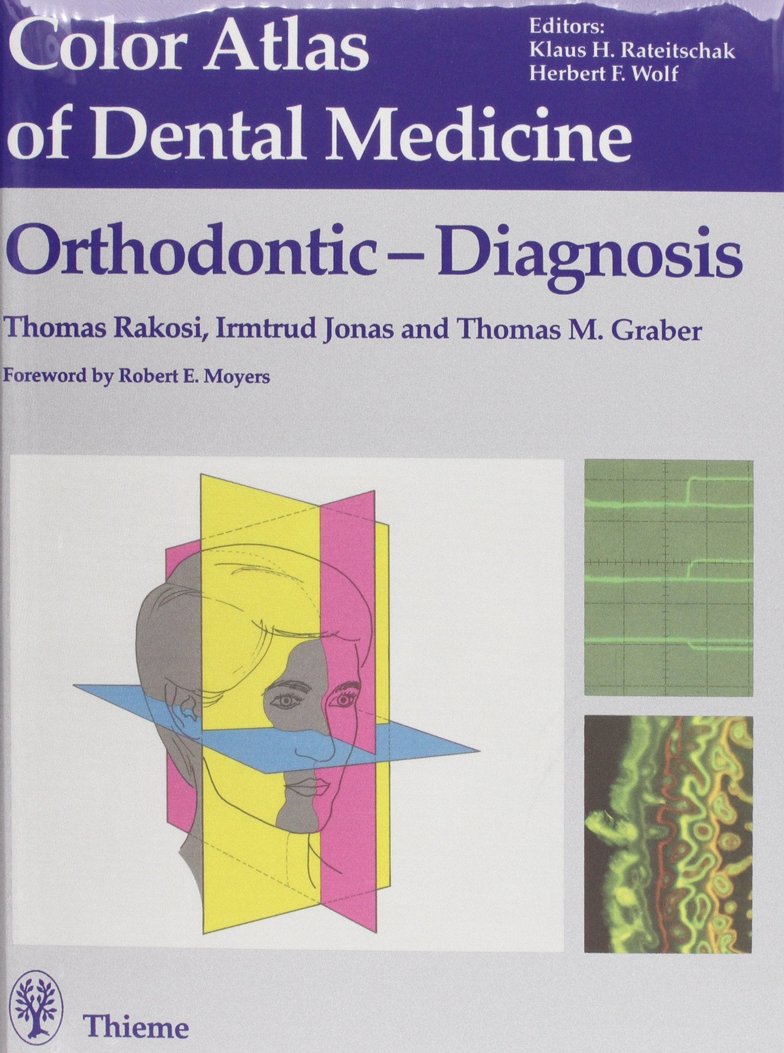 Color Atlas of Dental Medicine, Orthodontic Diagnosis: Forew. by Robert E. Moyers. (Farbatlanten engl.) Medicine