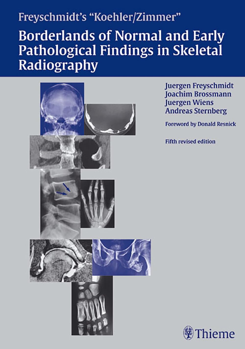 Borderlands of Normal and Early Pathologic Findings in Skeletal Radiograph Medicine