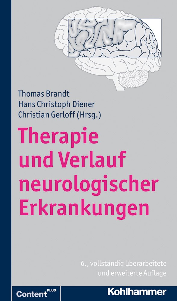 Therapie und Verlauf neurologischer Erkrankungen: Auch als Online-Datenbank. Gratis: 6-monatiger Testzugang Medicine