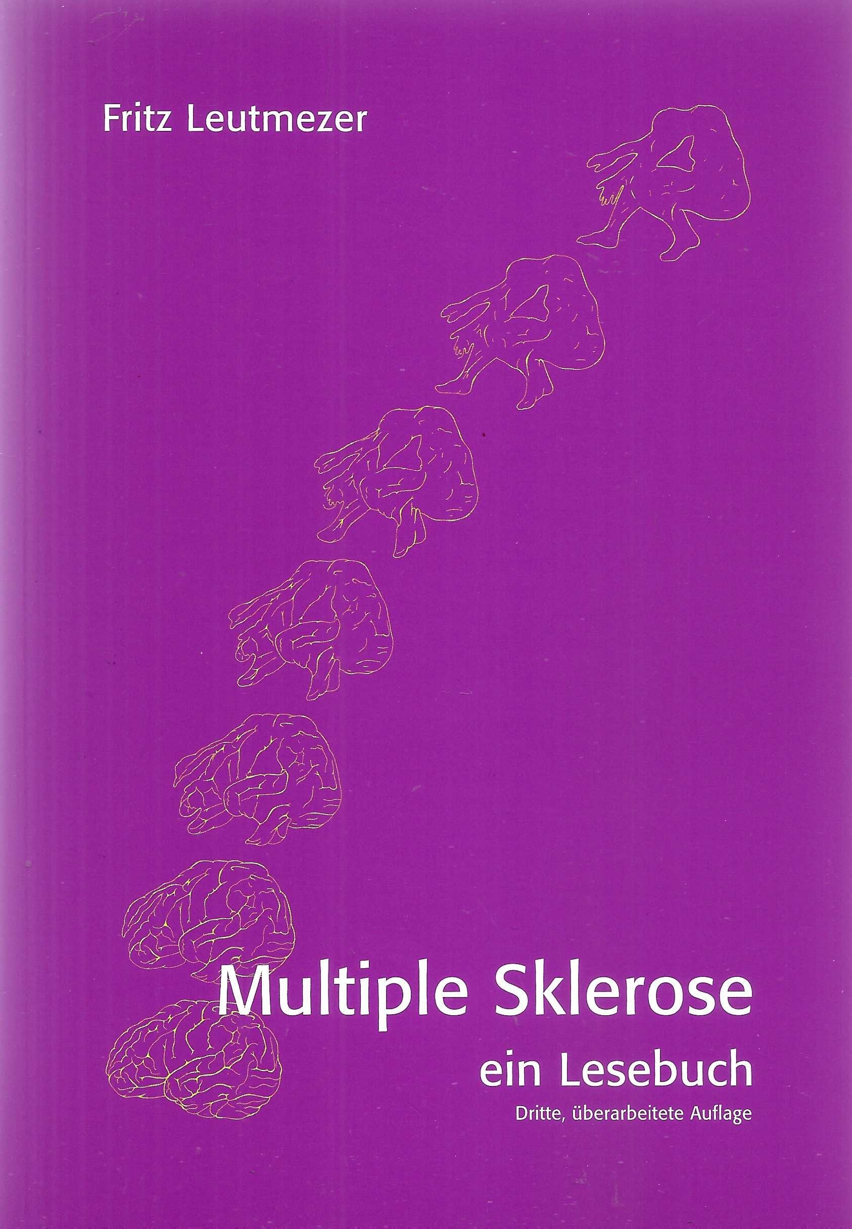 Multiple Sklerose: Ein Lesebuch Health, Nutrition & Fitness Books