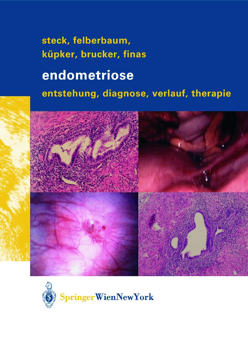 Endometriose: Entstehung, Diagnose, Verlauf und Therapie Medicine
