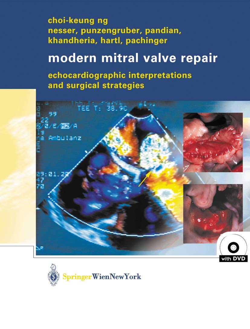 Modern Mitral Valve Repair: Echocardiographic Interpretations and Surgical Strategies Medicine