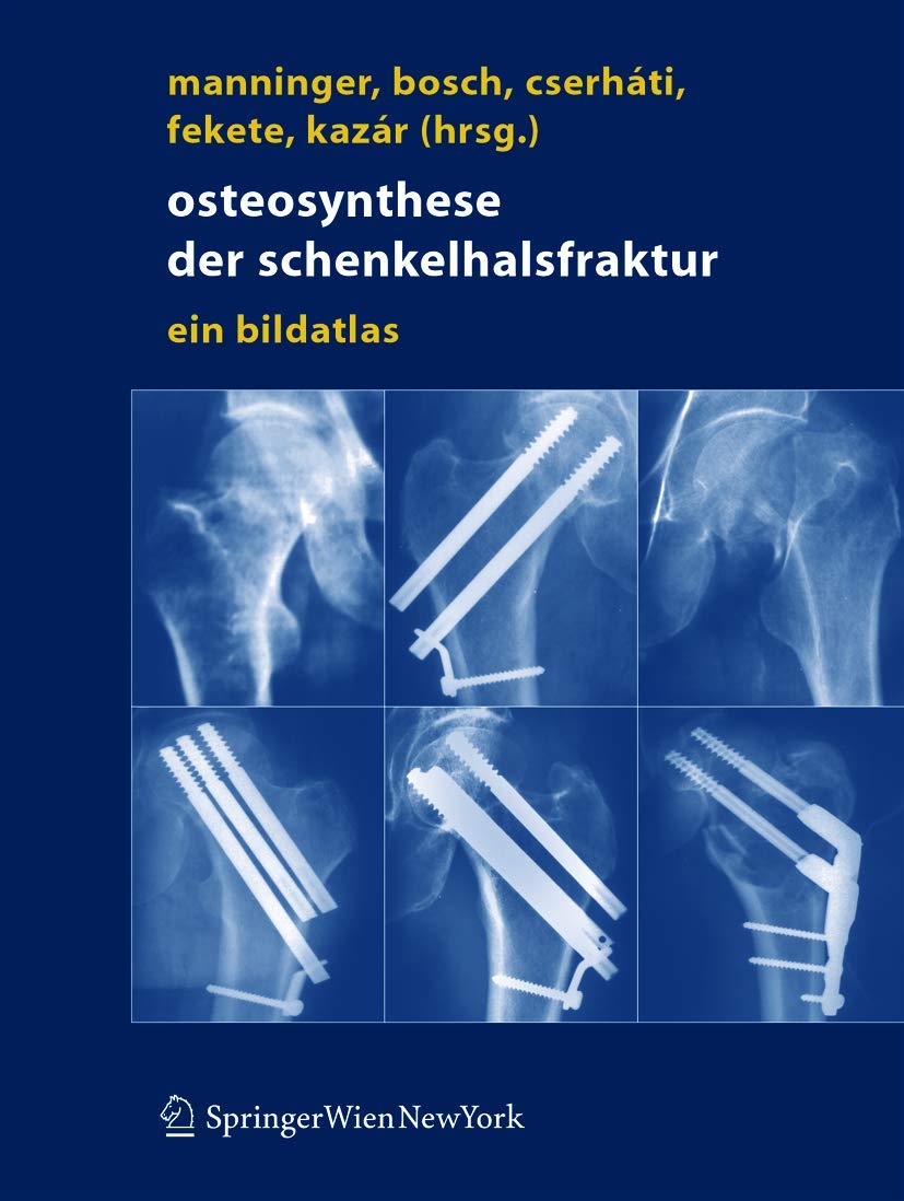 Osteosynthese der Schenkelhalsfraktur: Ein Bildatlas Medicine