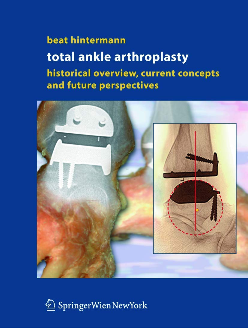 Total Ankle Arthroplasty: Historical Overview, Current Concepts and Future Perspectives Medicine