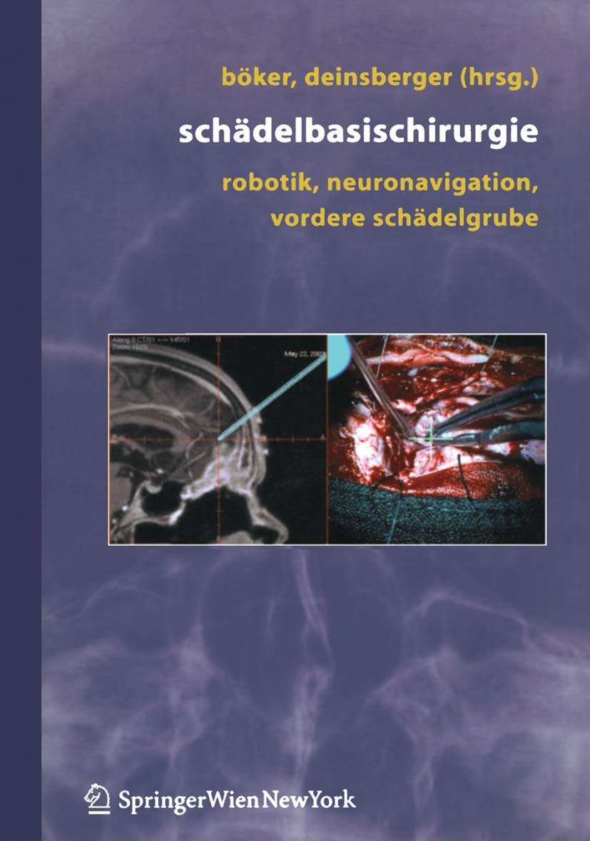 Schädelbasischirurgie: "Robotik, Neuronavigation, Vordere Schädelgrube" book