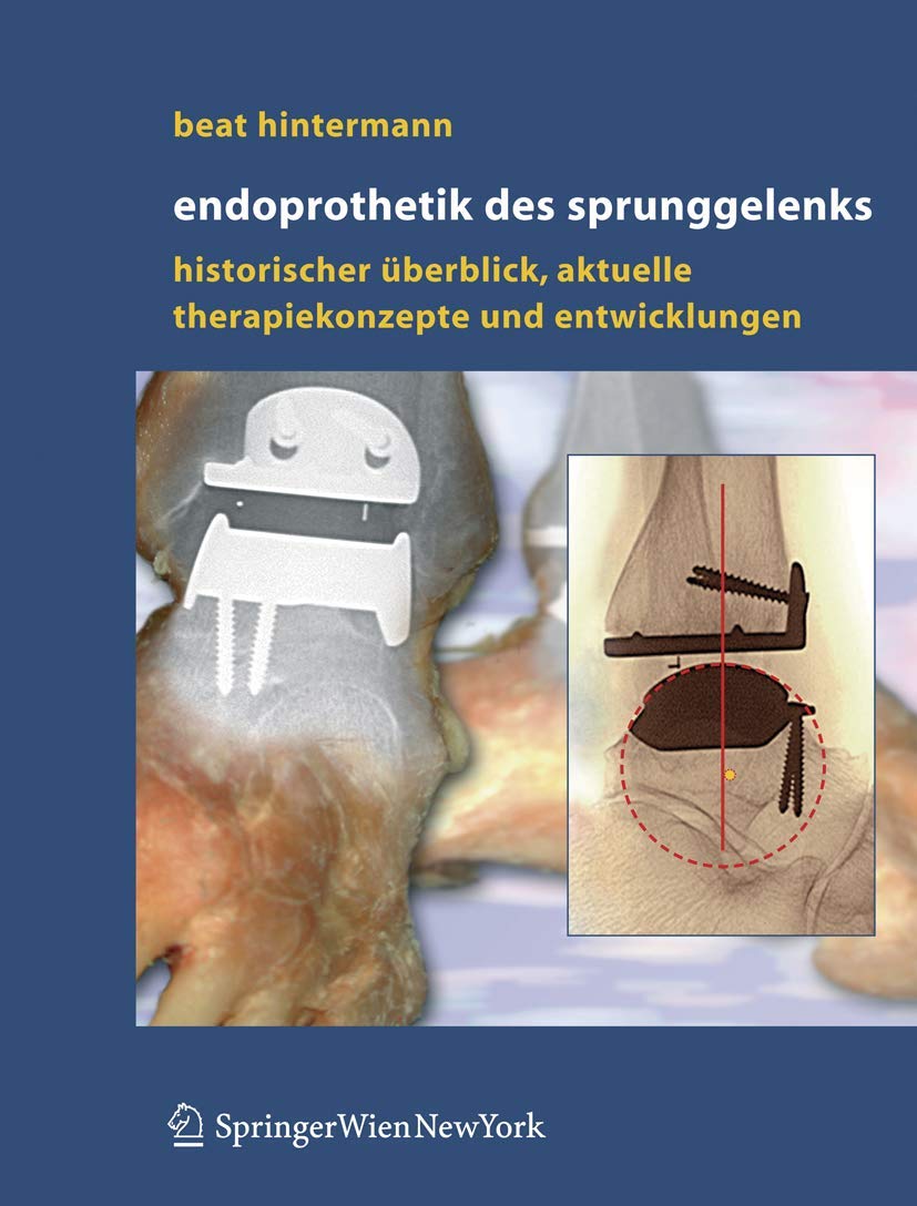 Endoprothetik des Sprunggelenks: Historischer Überblick, aktuelle Therapiekonzepte und Entwicklungen Medicine