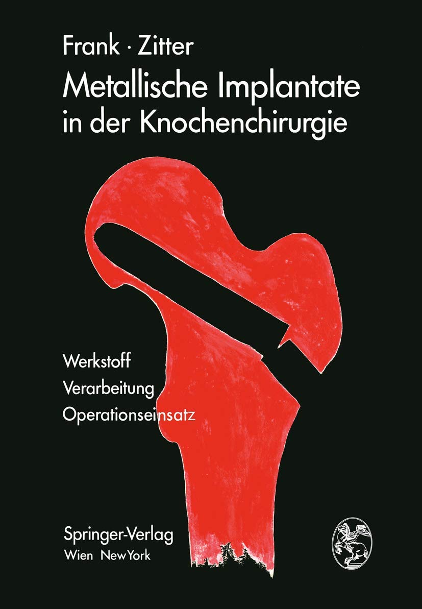 Metallische Implantate in der Knochenchirurgie: Werkstoff · Verarbeitung, Operationseinsatz Medicine