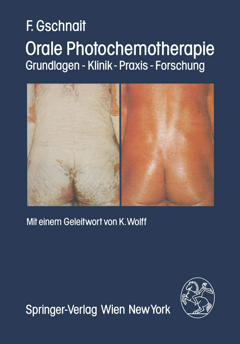 Orale Photochemotherapie: Grundlagen ― Klinik ― Praxis ― Forschung Medicine