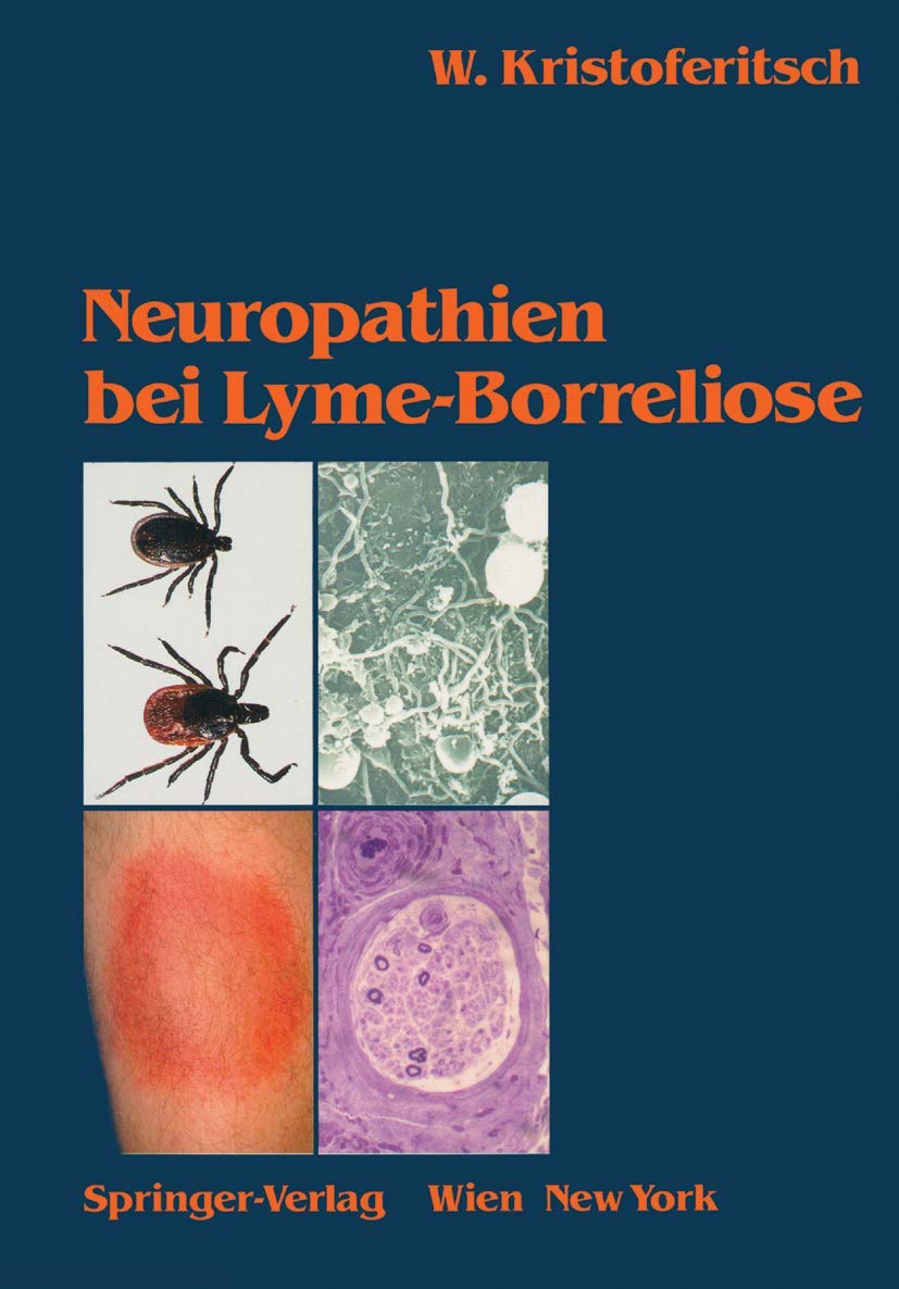 Neuropathien bei Lyme-Borreliose Medicine