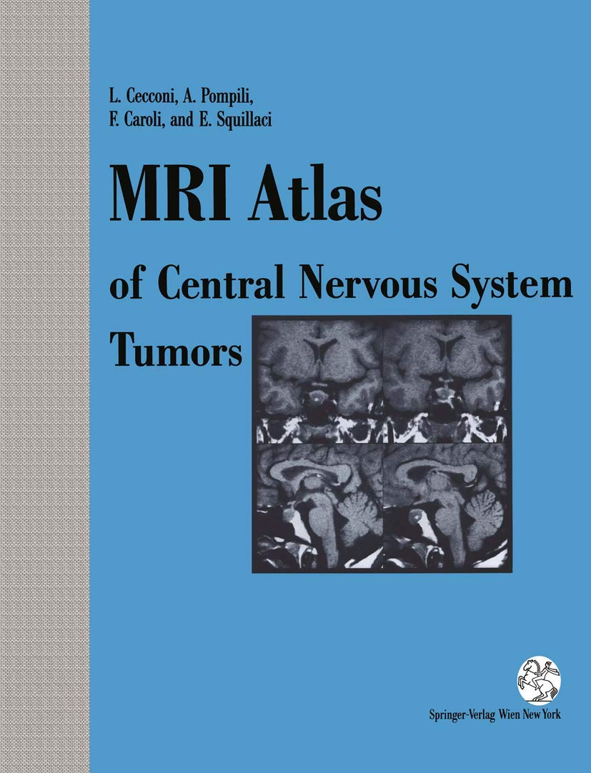 MRI Atlas of Central Nervous System Tumors Medicine