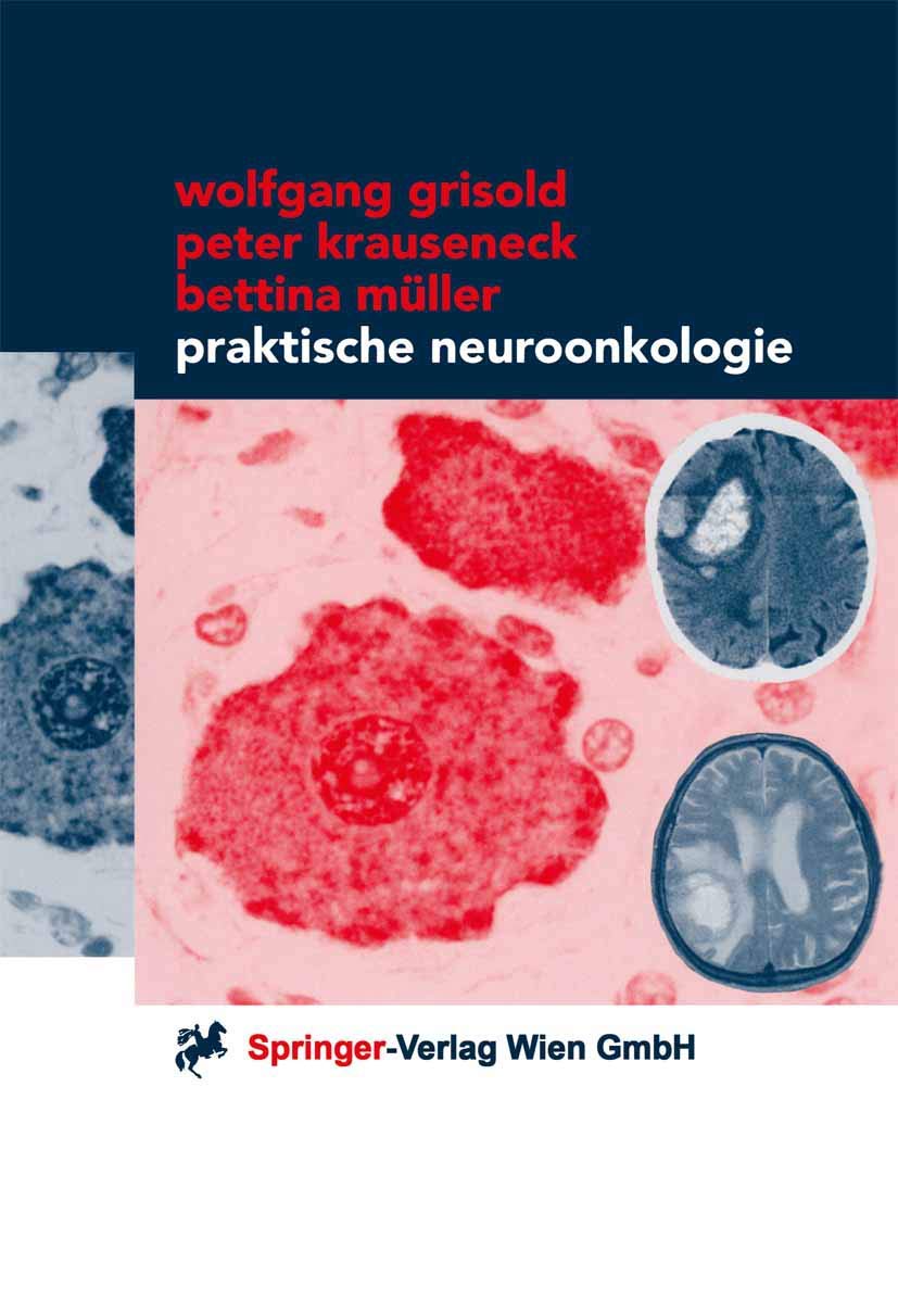 Praktische Neuroonkologie (German Edition) Medicine