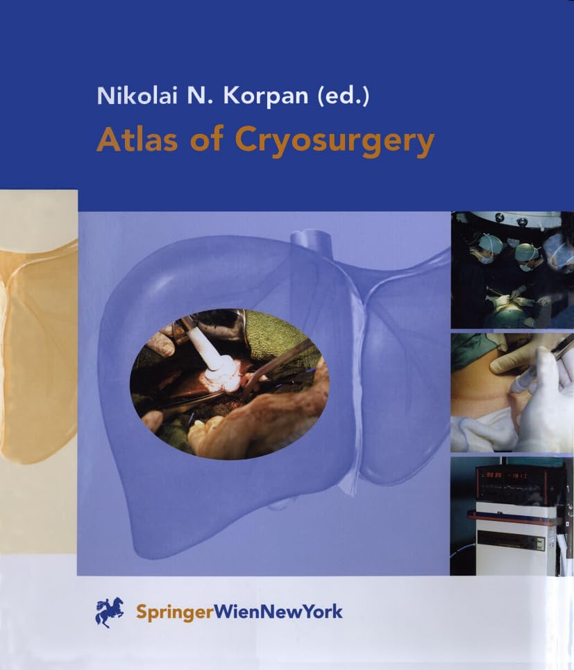 Atlas of Cryosurgery Medicine