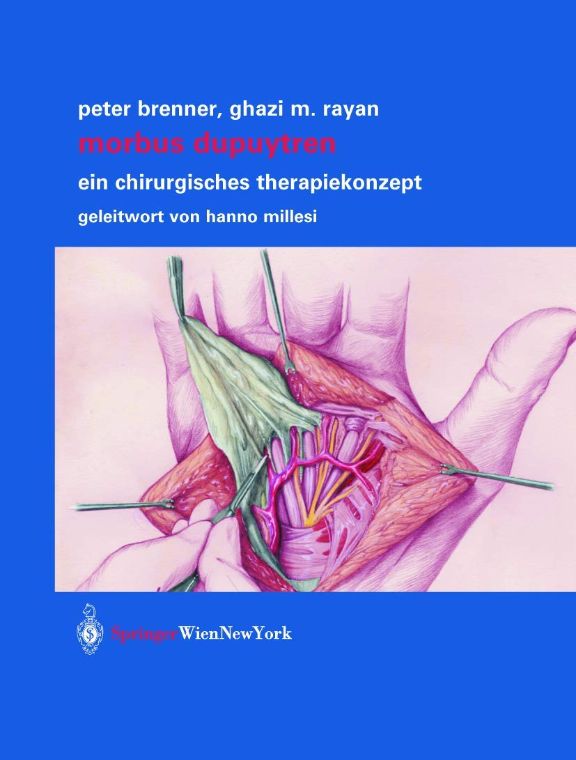 Morbus Dupuytren: Ein chirurgisches Therapiekonzept Medicine
