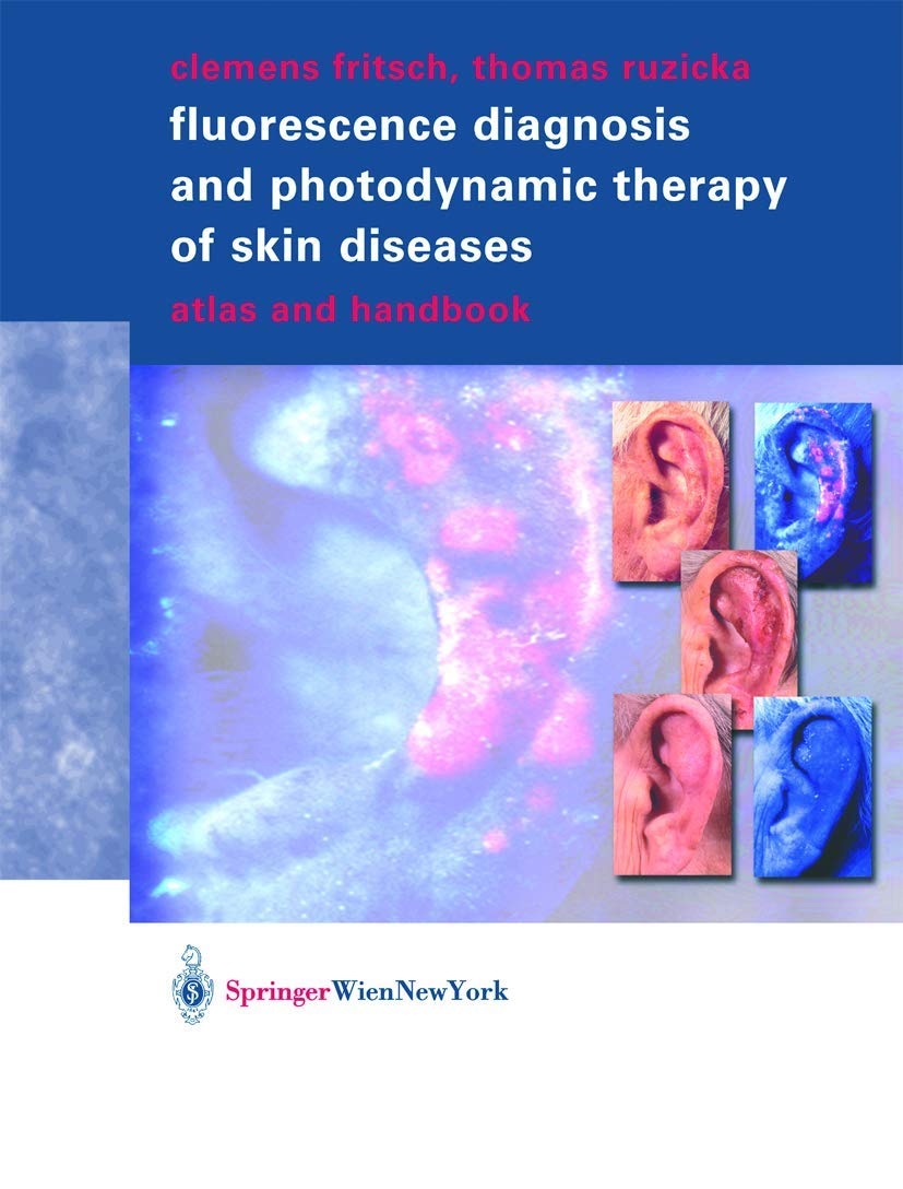 Fluorescence Diagnosis and Photodynamic Therapy of Skin Diseases Medicine