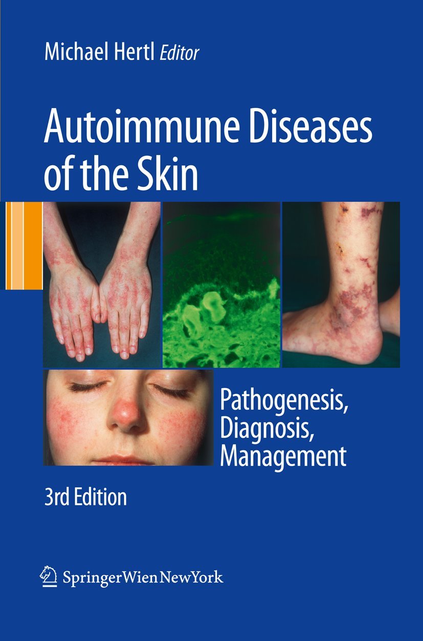 Autoimmune Diseases of the Skin Medicine