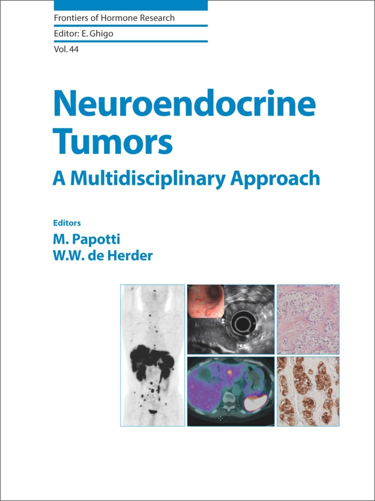 Neuroendocrine Tumors: A Multidisciplinary Approach (Frontiers of Hormone Research, Band 44) Medicine