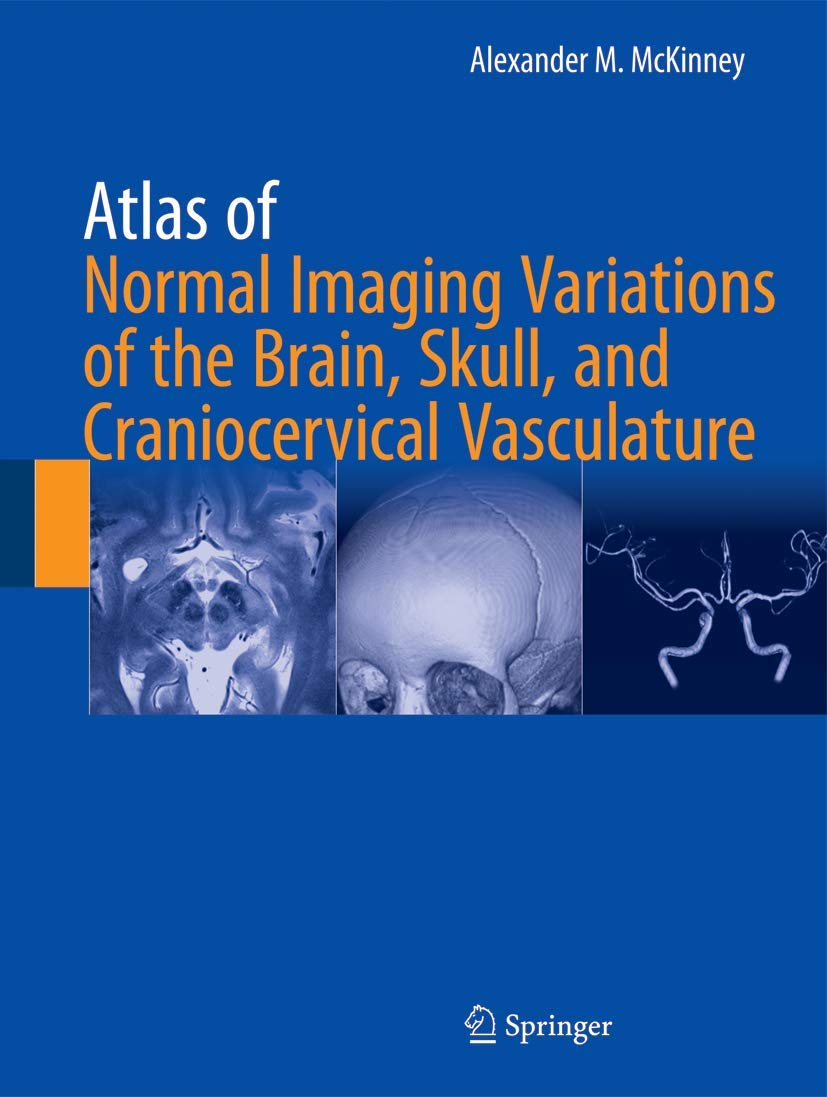 Atlas of Normal Imaging Variations of the Brain, Skull, and Craniocervical Vasculature book