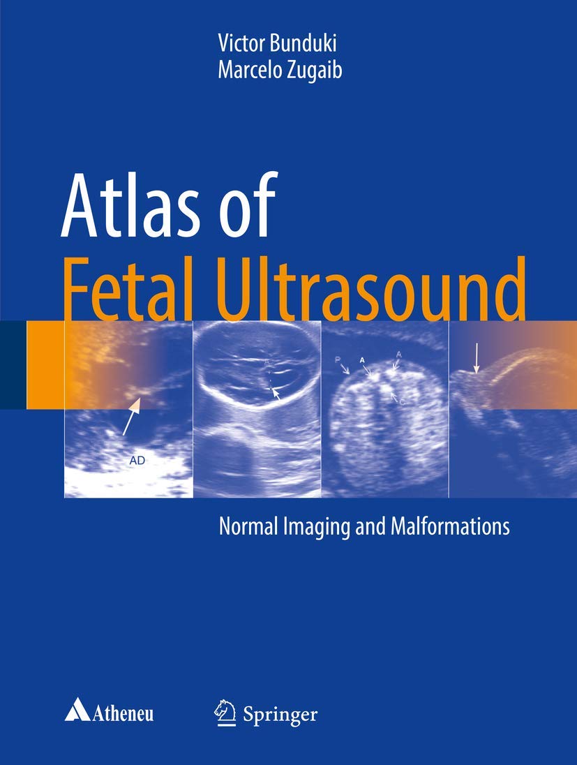 Atlas of Fetal Ultrasound: Normal Imaging and Malformations book