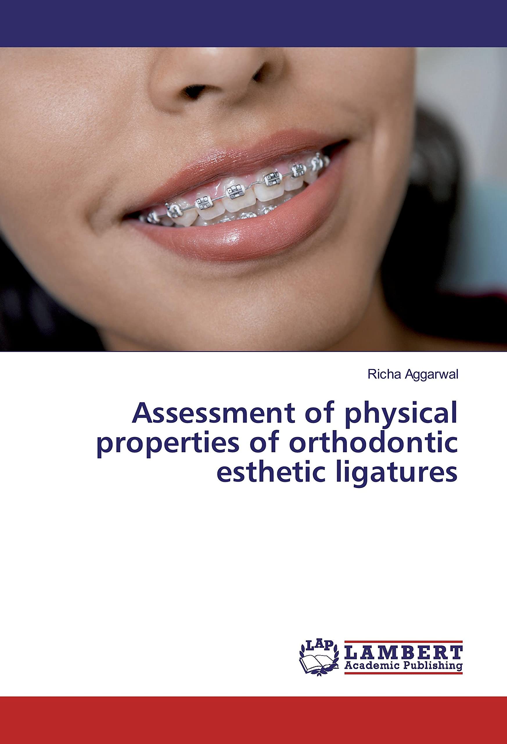 Assessment of physical properties of orthodontic esthetic ligatures Medicine