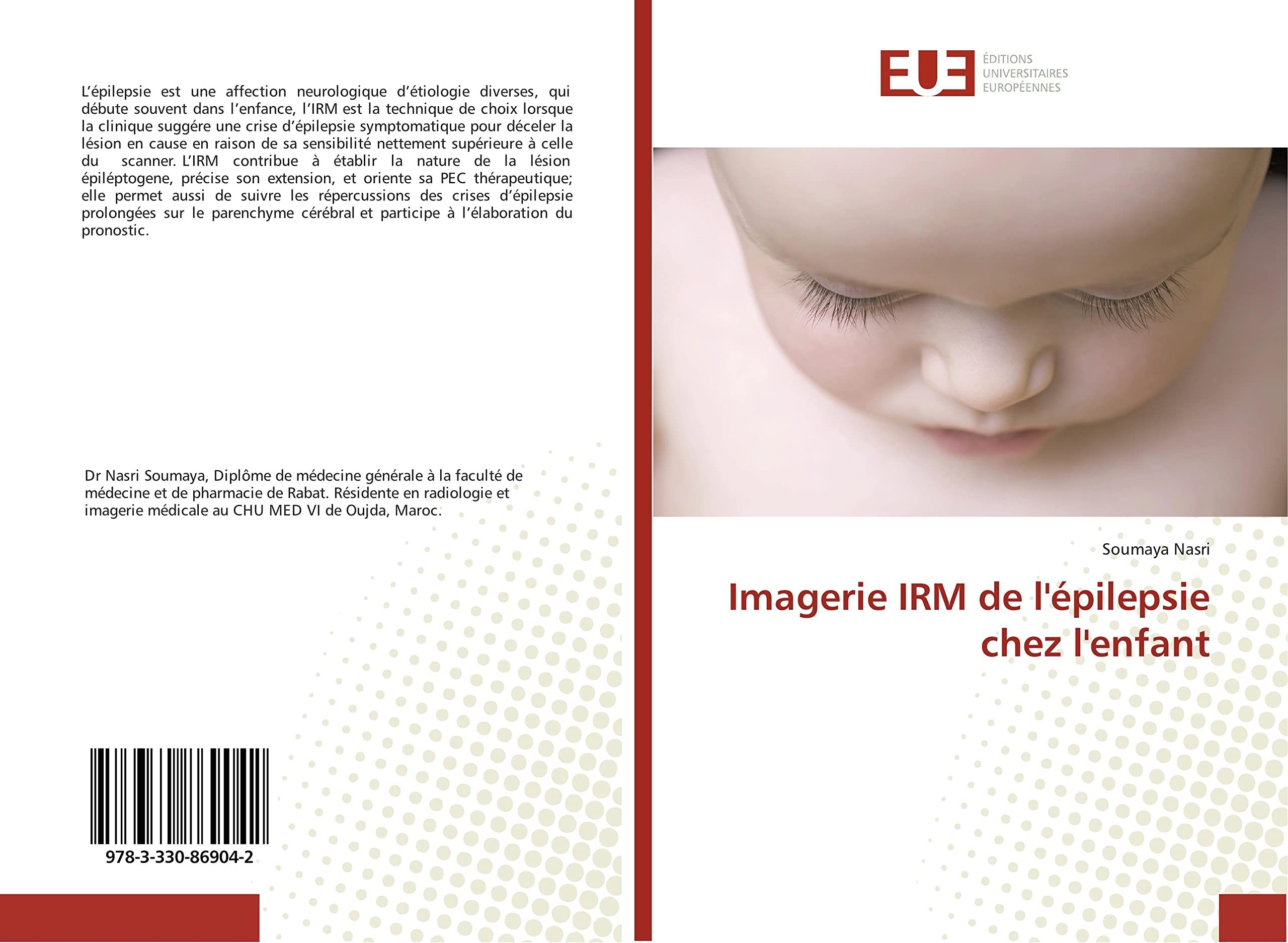 Imagerie IRM de l'épilepsie chez l'enfant book