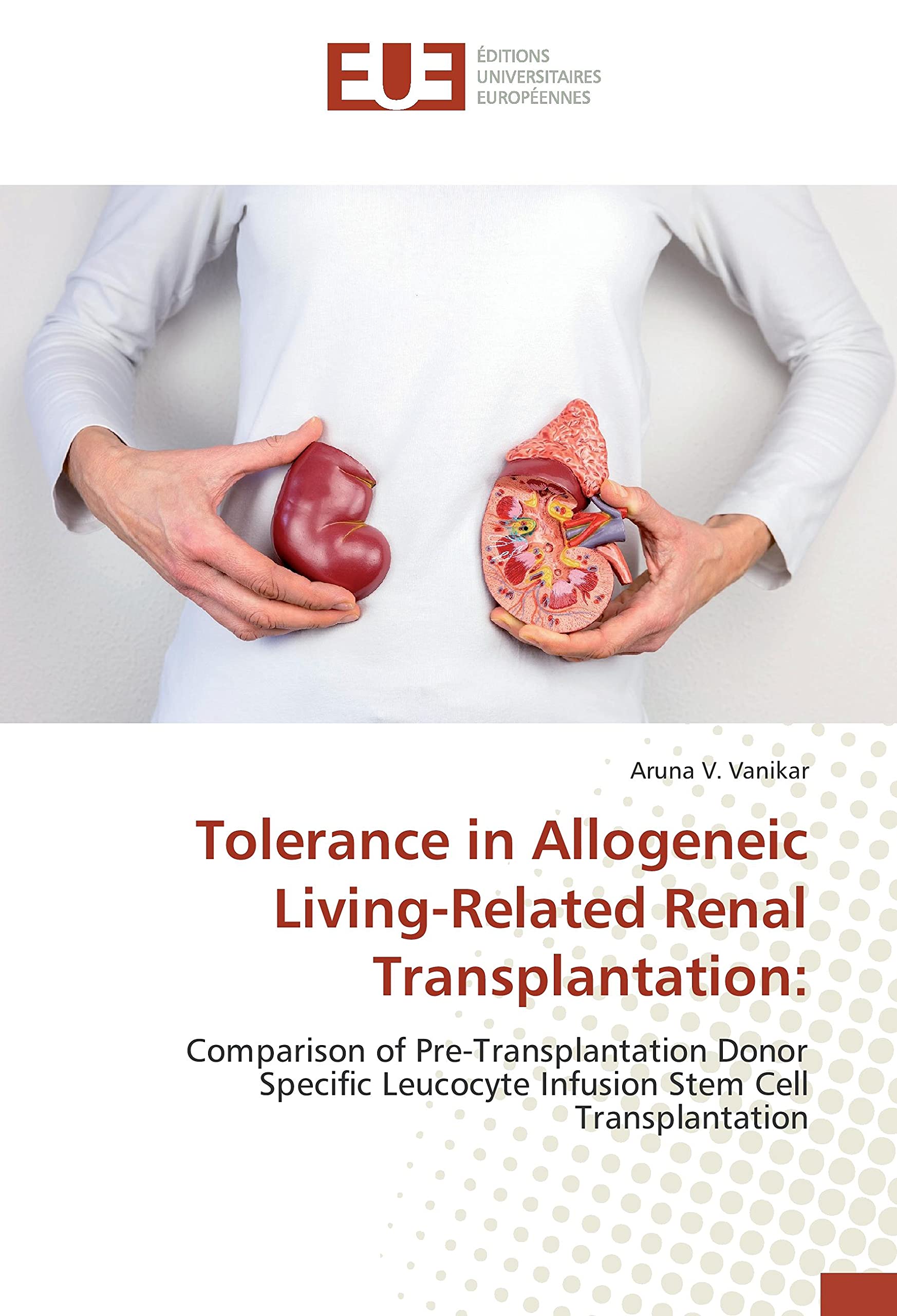 Tolerance in Allogeneic Living-Related Renal Transplantation:: Comparison of Pre-Transplantation Donor Specific Leucocyte Infusion Stem Cell Transplantation book