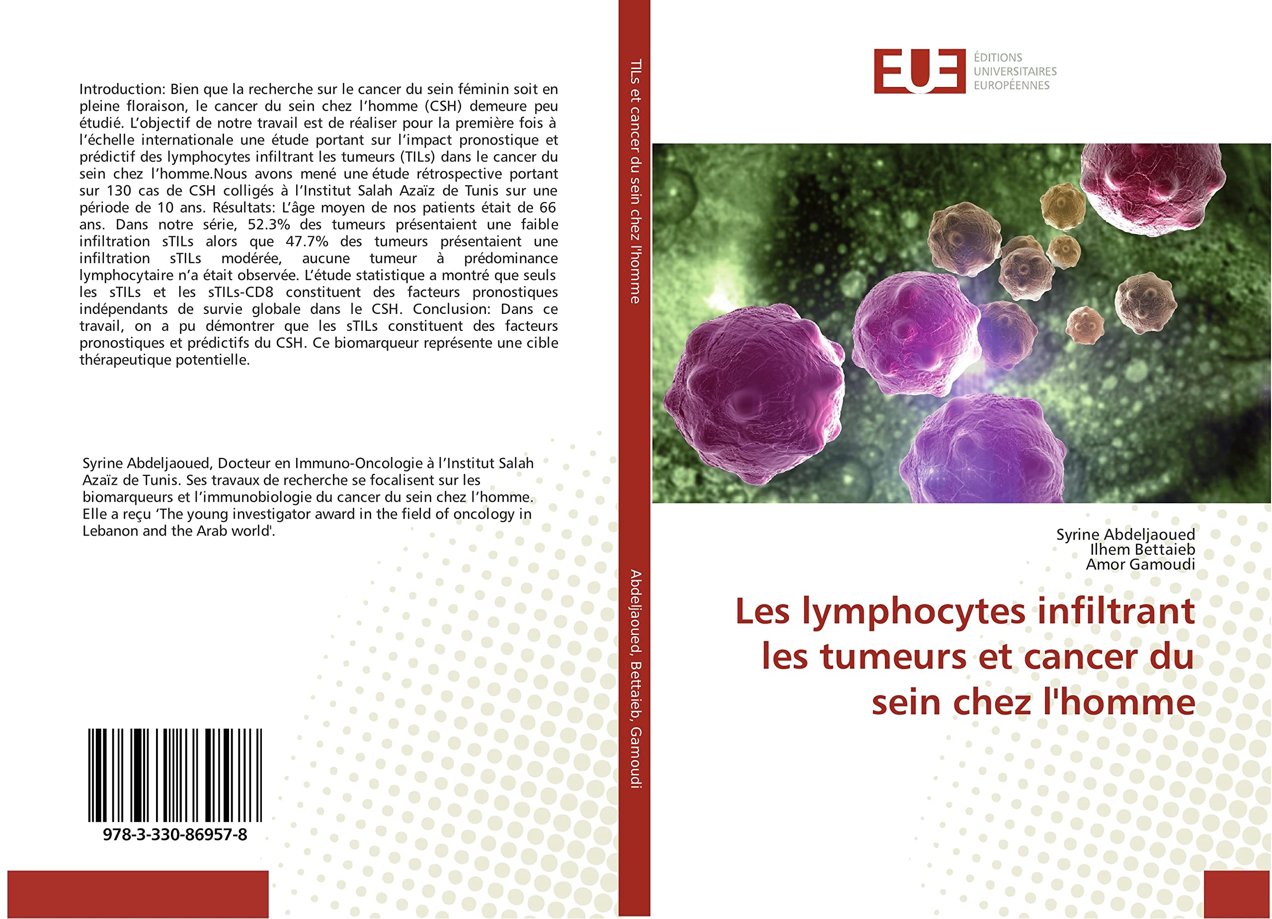 Les lymphocytes infiltrant les tumeurs et cancer du sein chez l'homme book