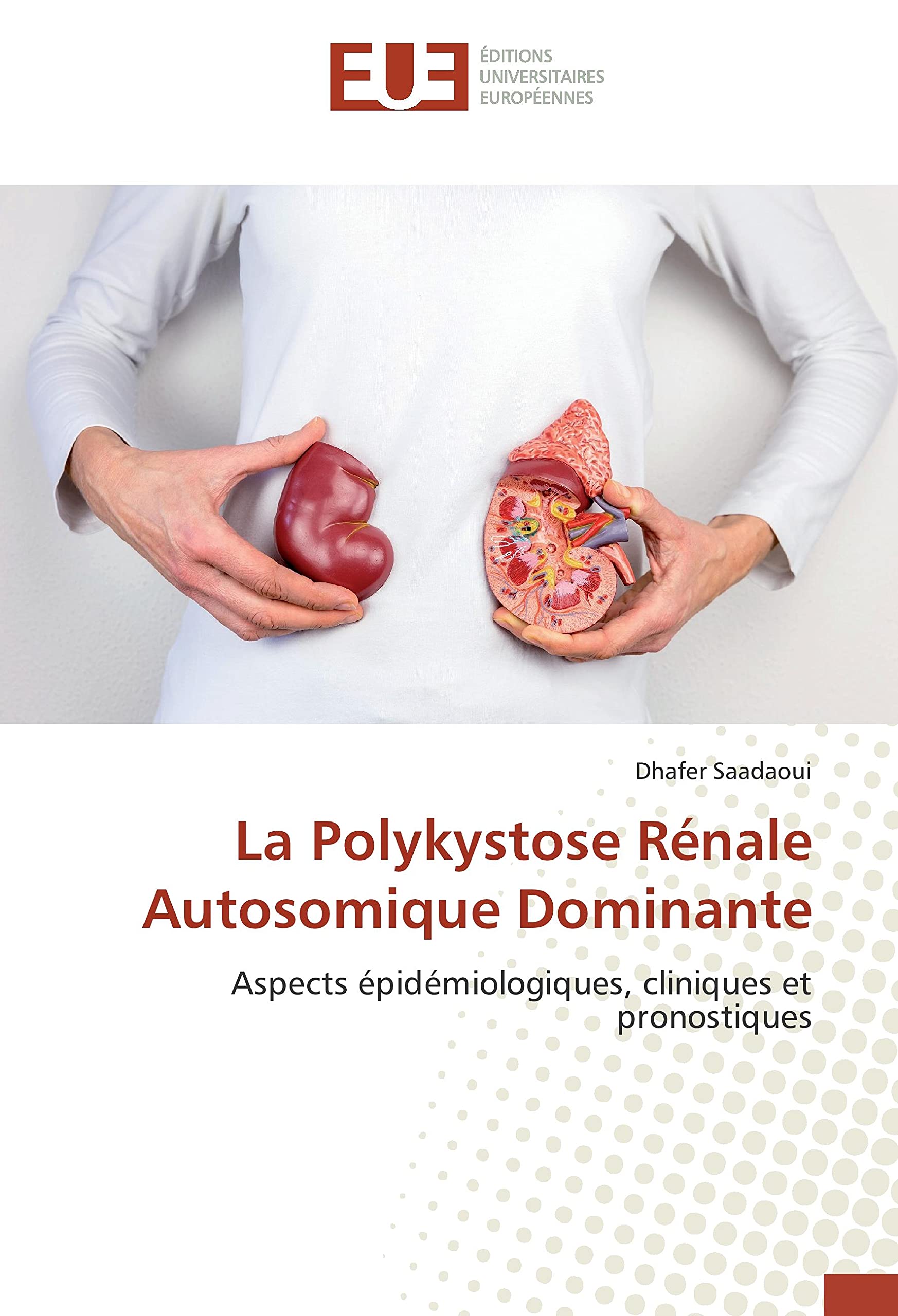 La Polykystose Rénale Autosomique Dominante: Aspects épidémiologiques, cliniques et pronostiques book