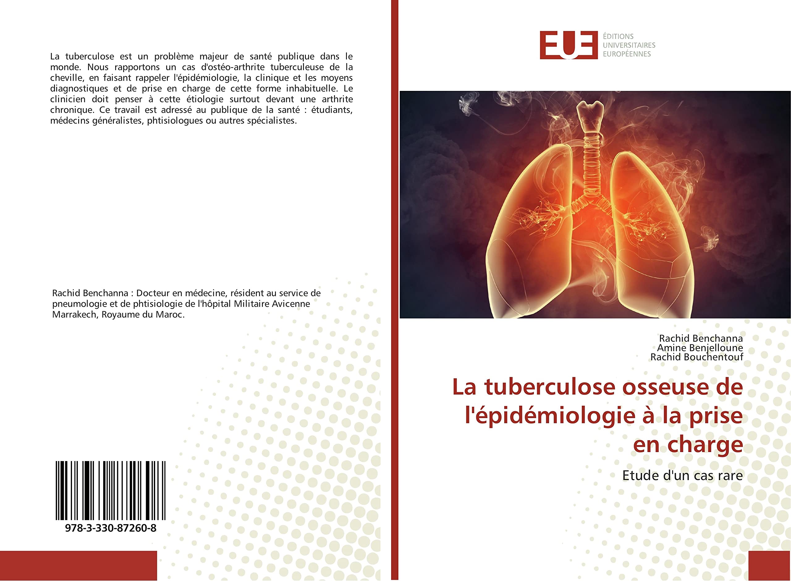 La tuberculose osseuse de l'épidémiologie à la prise en charge: Etude d'un cas rare book