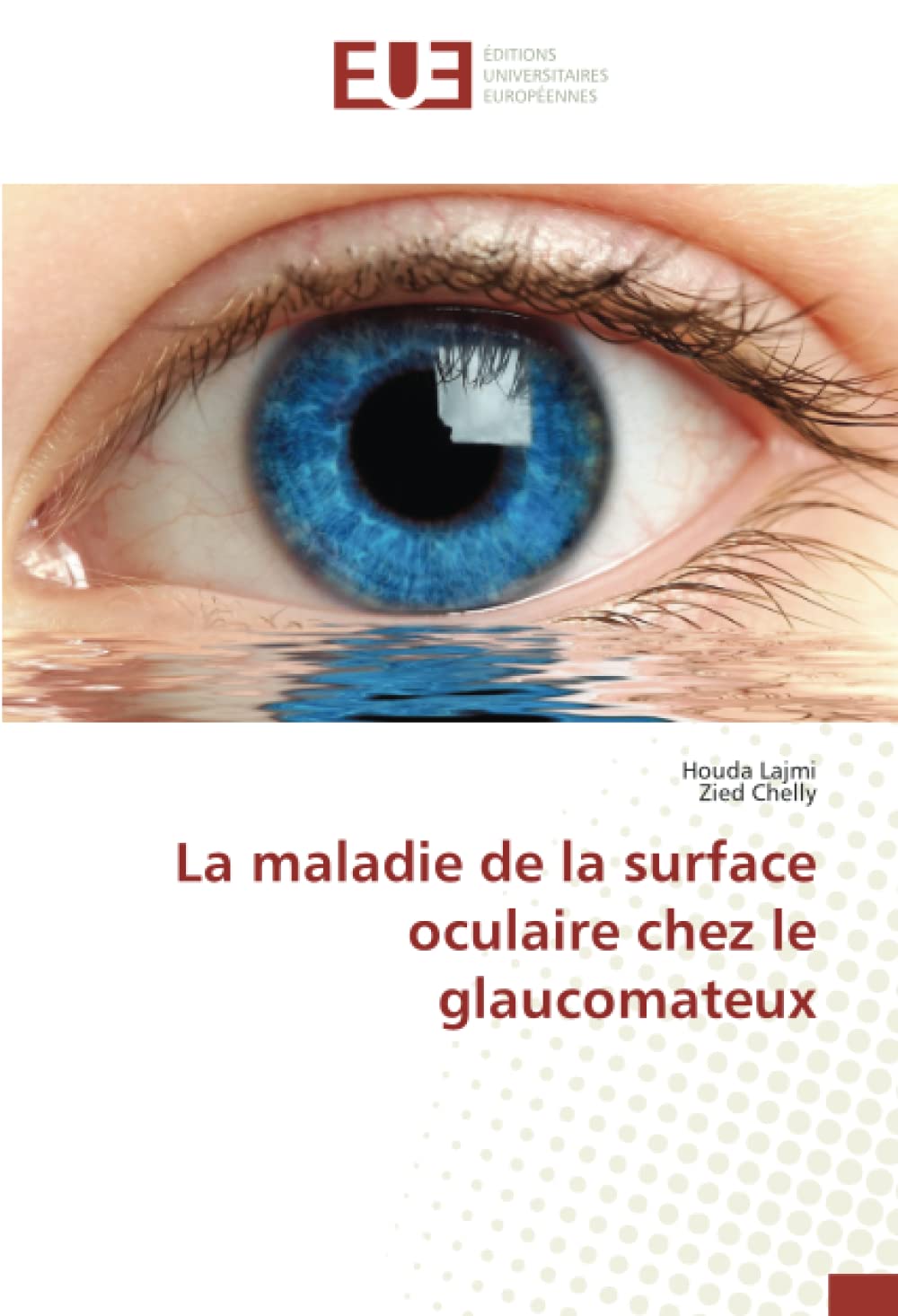 La maladie de la surface oculaire chez le glaucomateux book