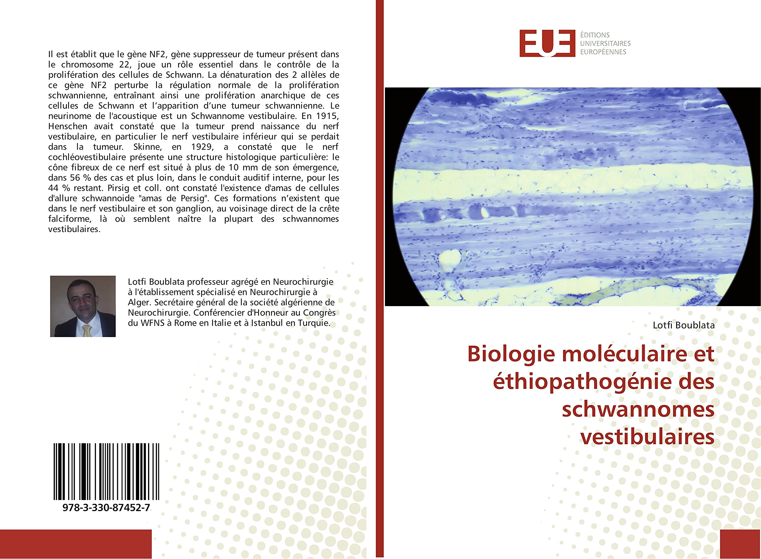 Biologie moléculaire et éthiopathogénie des schwannomes vestibulaires book