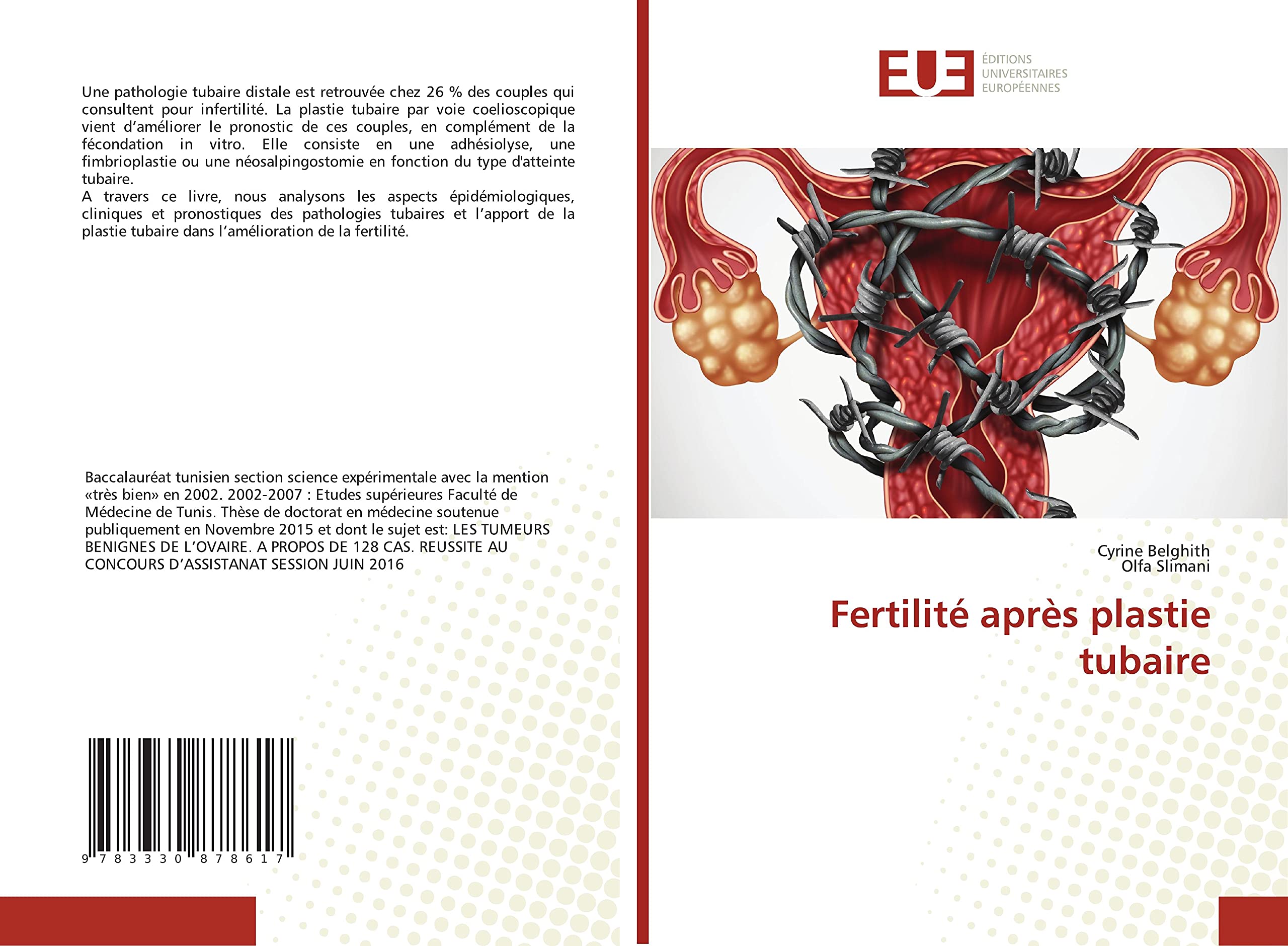 Fertilité après plastie tubaire Medicine