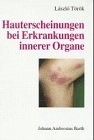 Hauterscheinungen bei Erkrankungen innerer Organe : mit 56 Tabellen. Books