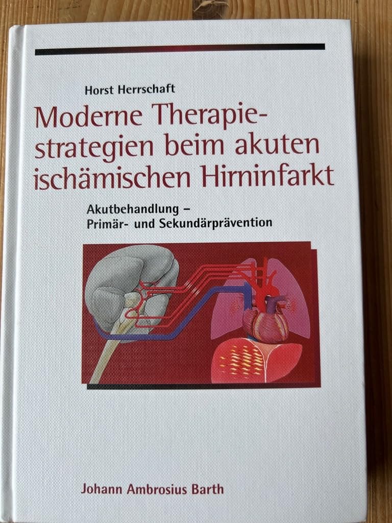 Moderne Therapiestrategien beim akuten ischämischen Hirninfarkt. Akutbehandlung Sekundärprävention Medicine
