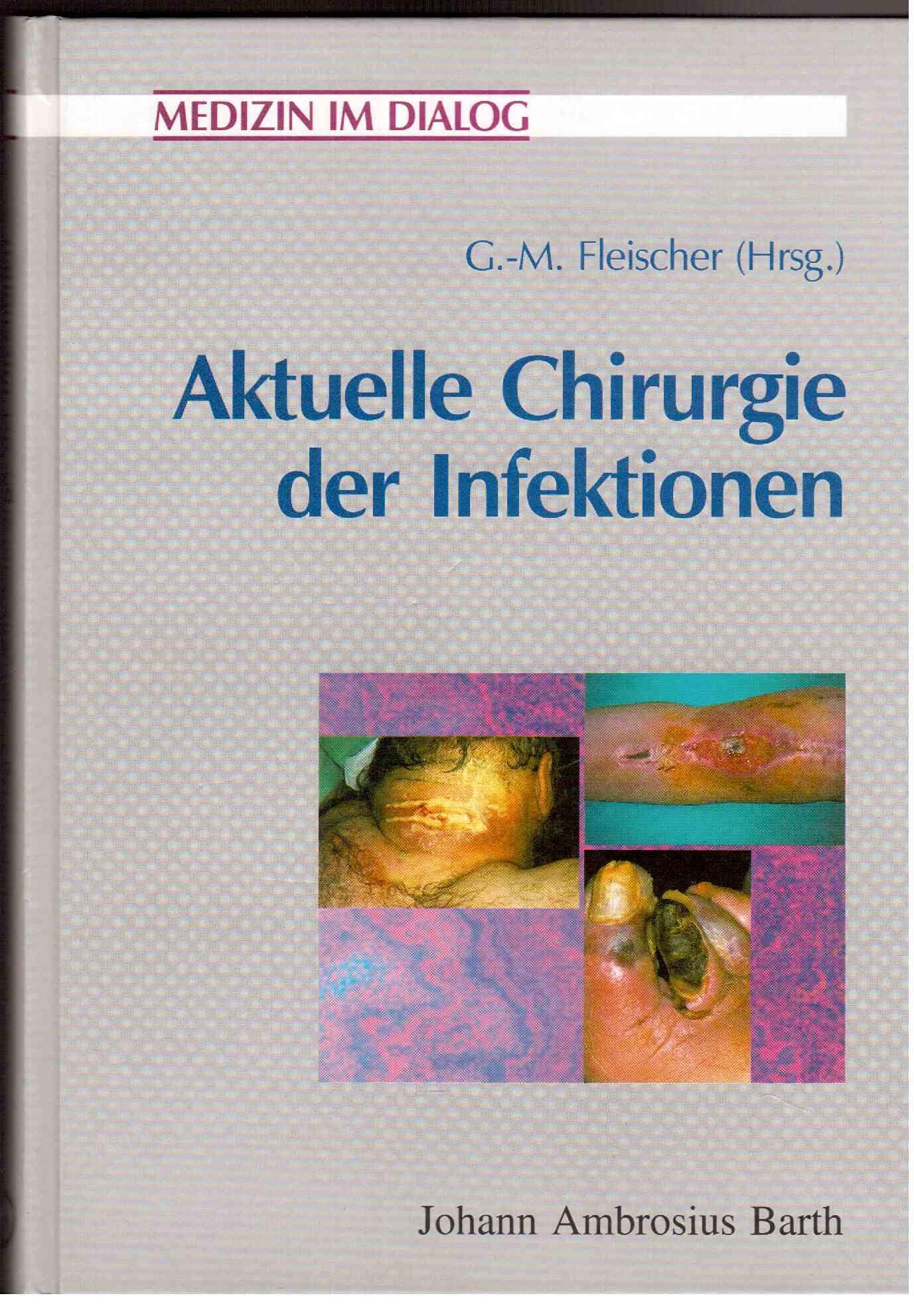 Aktuelle Chirurgie der Infektionen Medicine
