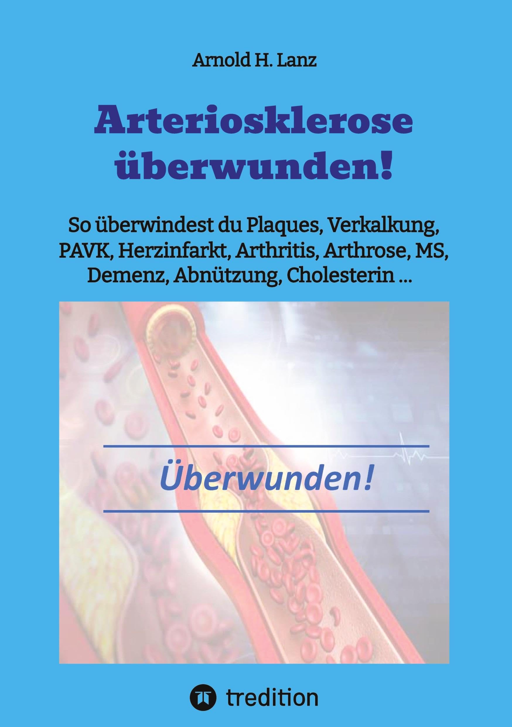 Arteriosklerose überwunden! Leisure, Home & Garden