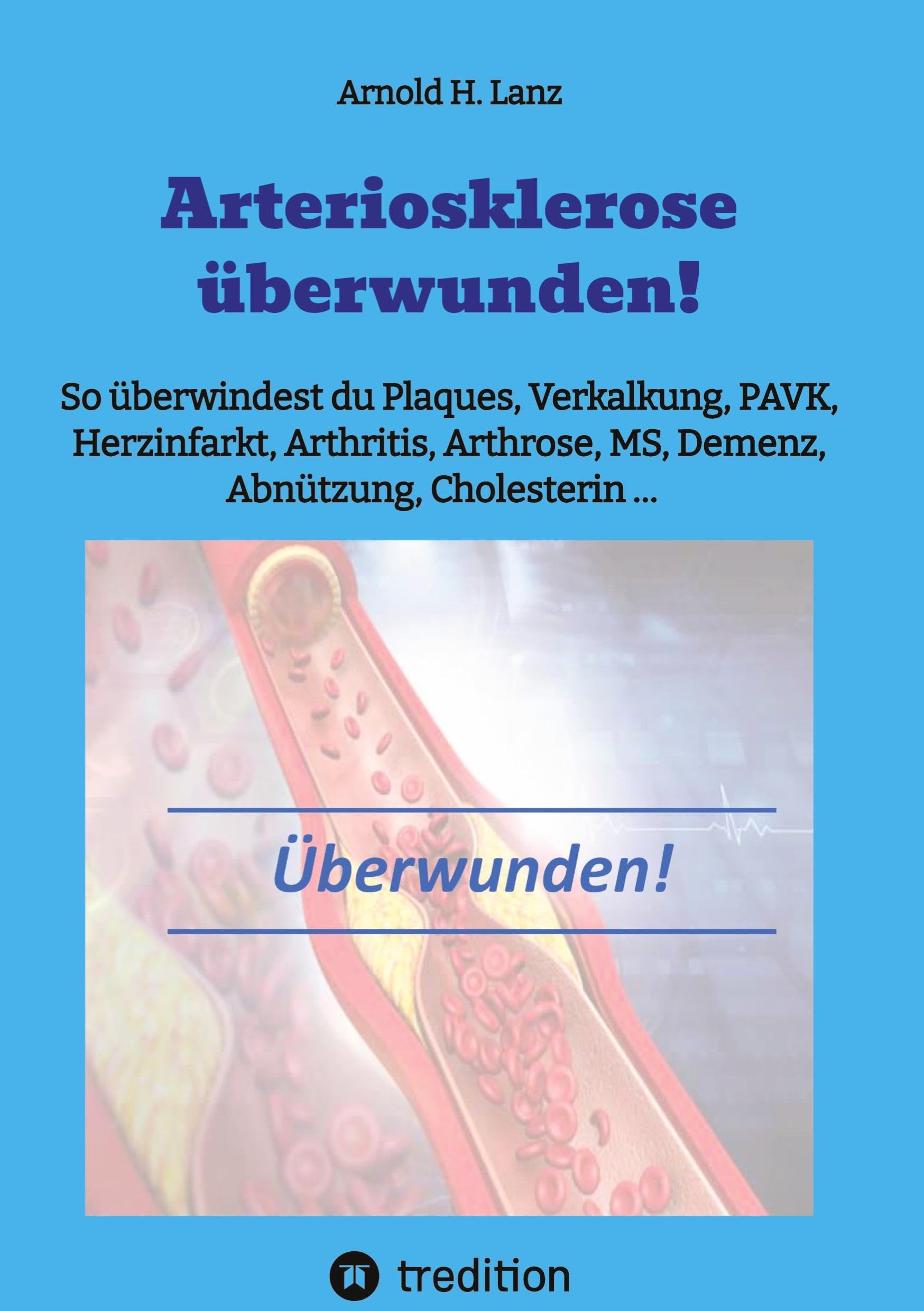 Arteriosklerose überwunden!: So überwindest du Plaques, Verkalkungen, PAVK, Herzinfarkt, Arthritis, Arthrose, MS, Demenz, Abnützung, Cholesterin ... Leisure, Home & Garden