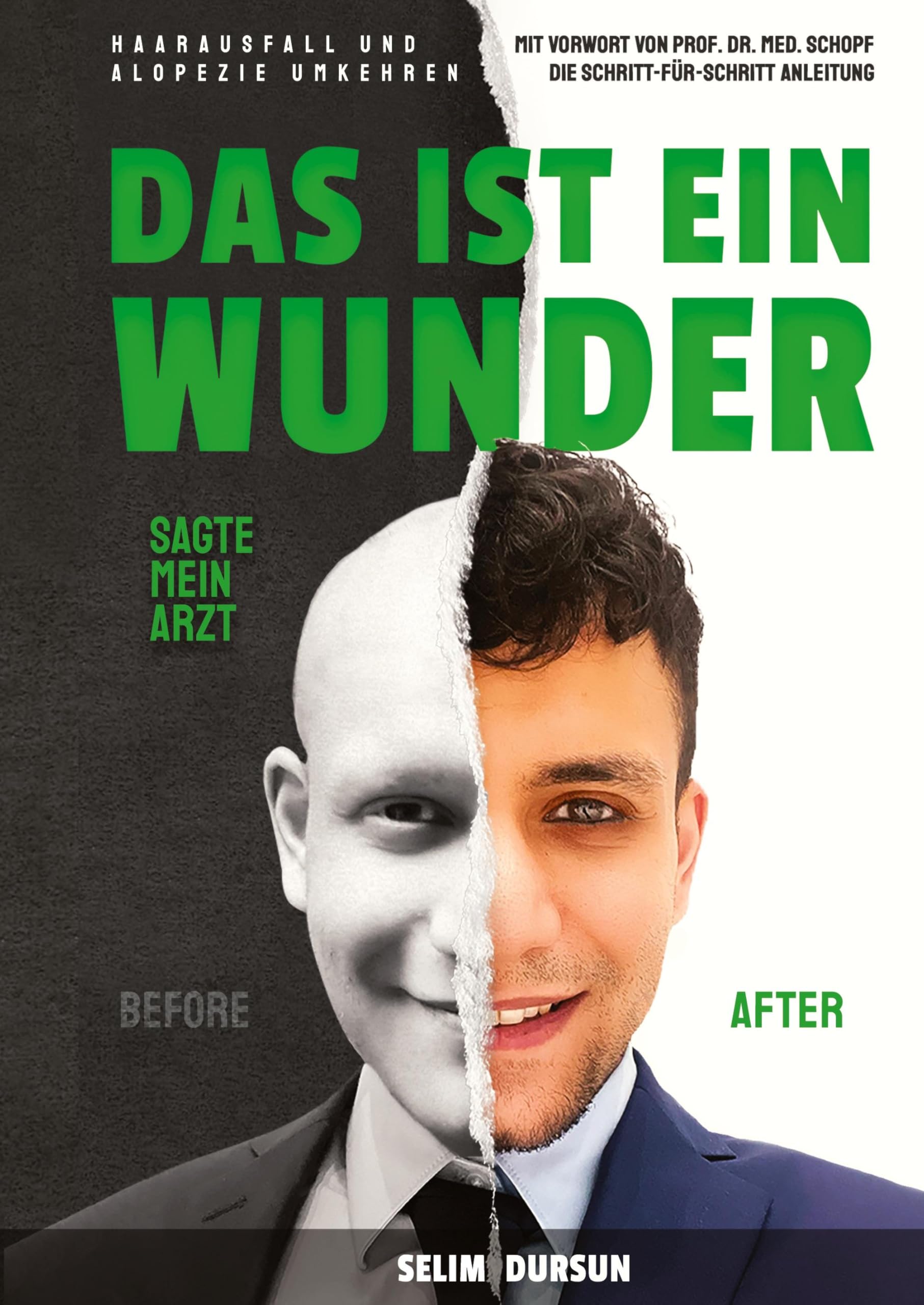 DAS IST EIN WUNDER SAGTE MEIN ARZT: HAARVERLUST UND ALOPEZIE UMKEHREN Leisure, Home & Garden