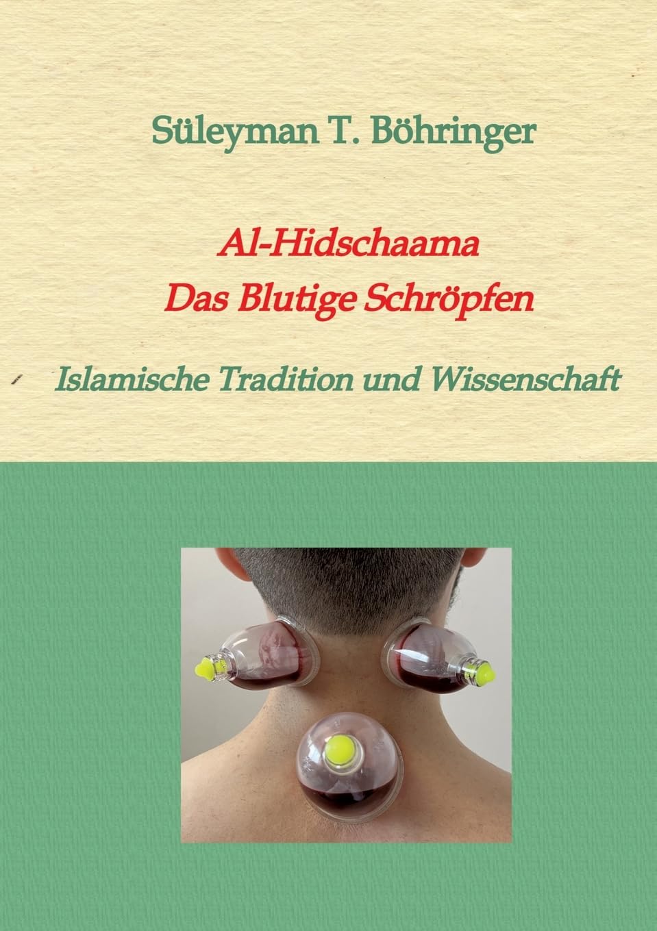 Al-Hidschaama Das Blutige Schröpfen: Islamische Tradition und Wissenschaft Medicine