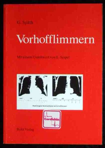 Vorhofflimmern Health, Nutrition & Fitness