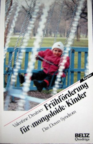 Frühförderung für "mongoloide" Kinder: Das Down Syndrom Medicine
