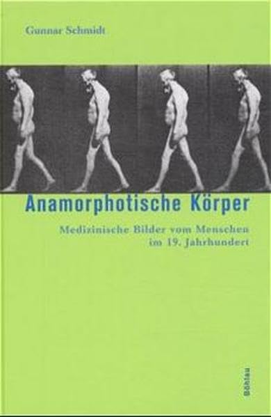 Anamorphotische Körper. Medizinische Bilder vom Menschen im 19. Jahrhundert Medicine