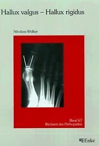Hallux valgus, Hallux rigidus Medicine